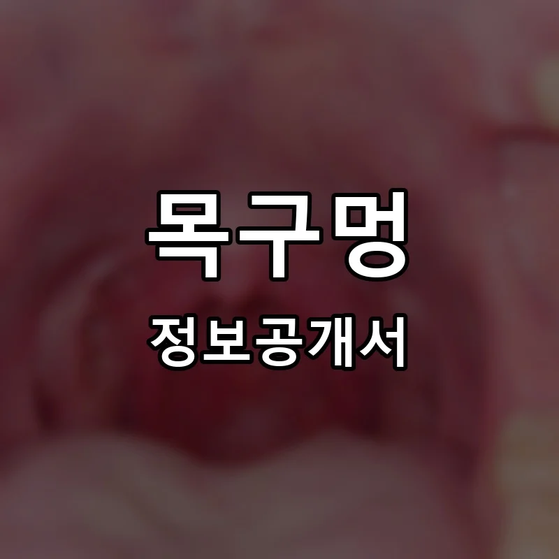 목구멍 프랜차이즈 창업 비용 정보공개서 요약