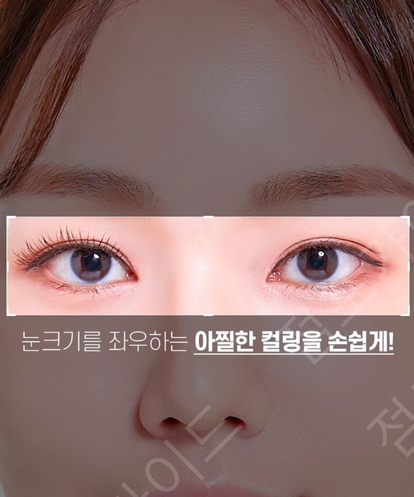 올림픽 금메달, 결국 사랑이 모든 것을 이겼다?